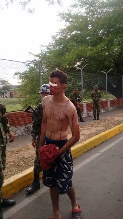 herido-frente-a-brigada-16--P.jpg - 94.98 kB