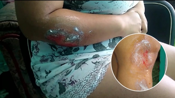 Otra mujer fue víctima de &#039;raponazo&#039; en Yopal