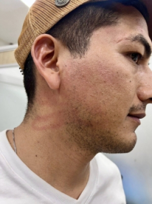 Concejal de Paz de Ariporo denunció agresión física por parte de un colega suyo