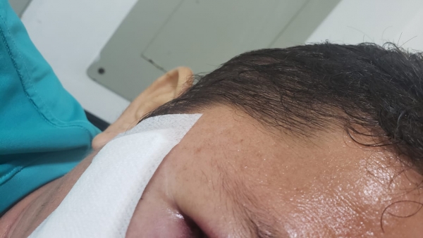 Comerciante terminó con un disparo alojado en el cráneo durante atraco en Aguazul