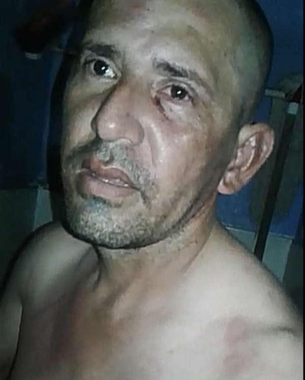 Golpeado en la cárcel, resultó señalado de feminicidio contra la menor del Meta