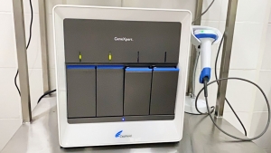 En Casanare ya se puede realizar diagnóstico oportuno de la Tuberculosis con equipos de alta tecnología