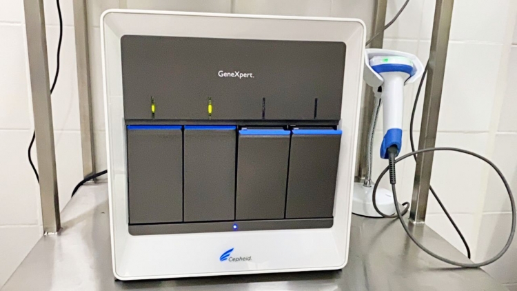 En Casanare ya se puede realizar diagnóstico oportuno de la Tuberculosis con equipos de alta tecnología