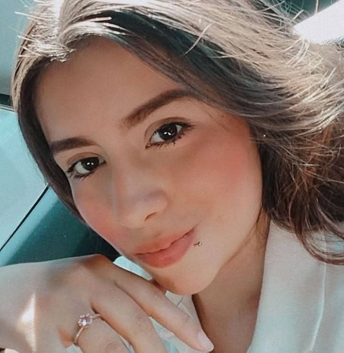 Joven de 21 años perdió la vida al estrellar su motocicleta contra un árbol