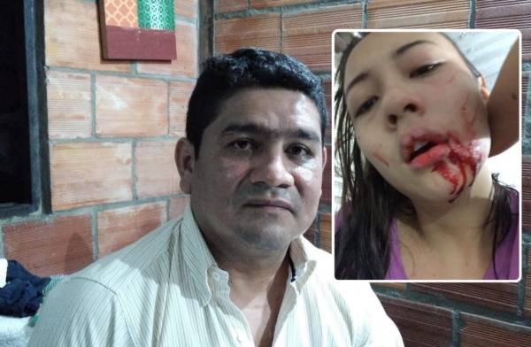 Presunto caso de violencia intrafamiliar en Yopal. Exaspirante al Concejo habría agredido a su hijastra